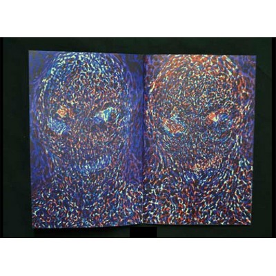 Mat Brinkmann: Heads Collider (le dernier cri)